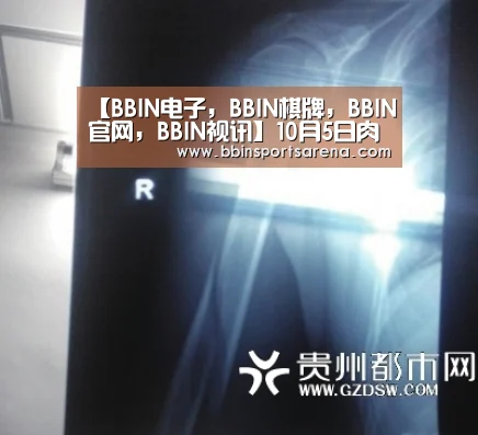 BBIN电子，BBIN棋牌，BBIN官网，BBIN视讯